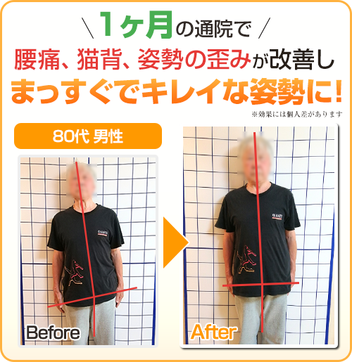 ビフォーアフター