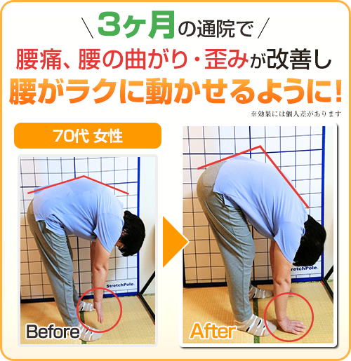 ビフォーアフター画像