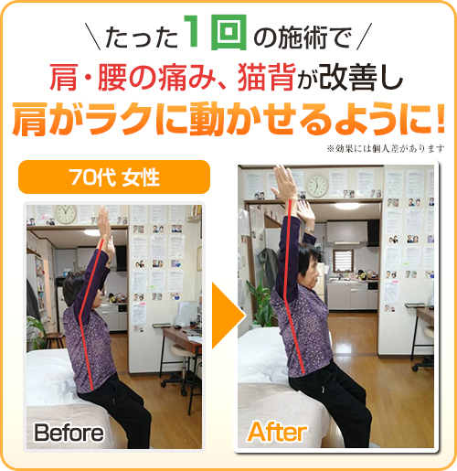 ビフォーアフター