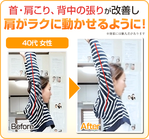 ビフォーアフター