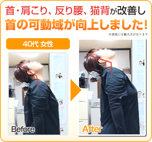 ビフォーアフター