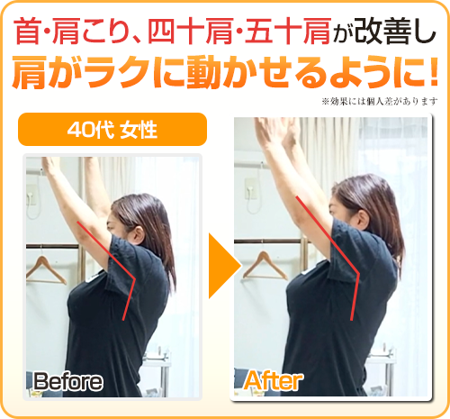 ビフォーアフター