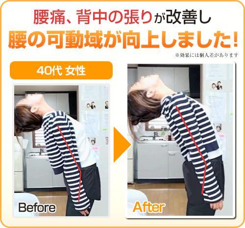 ビフォーアフター