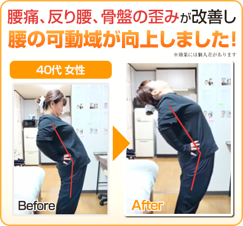 ビフォーアフター画像