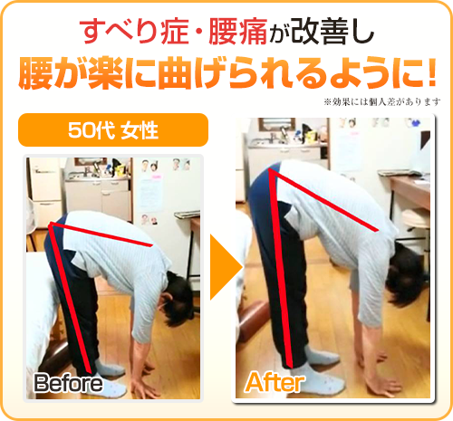 ビフォーアフター