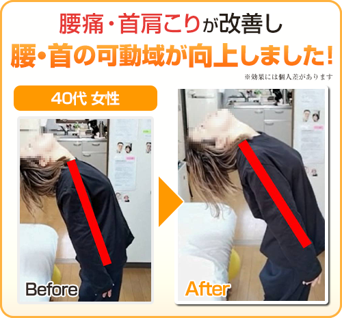 ビフォーアフター
