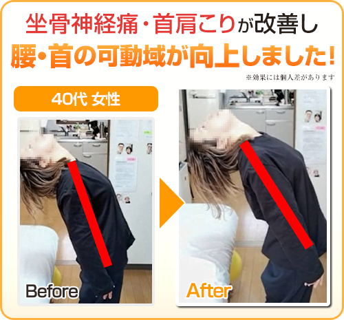 ビフォーアフター