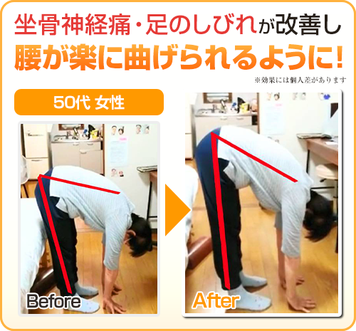 ビフォーアフター画像