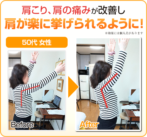ビフォアフター