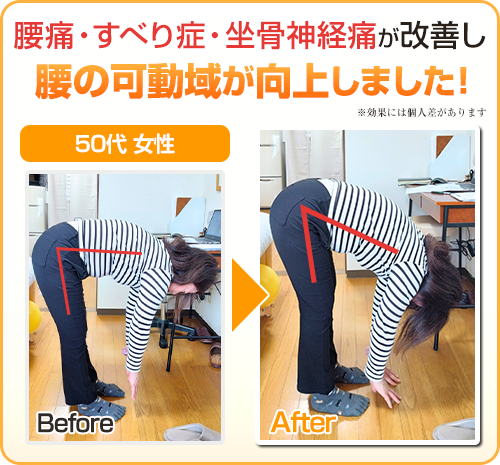 ビフォアフター