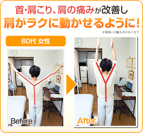 ビフォアフター