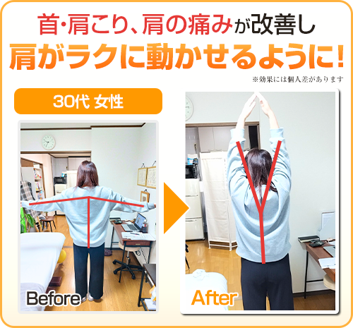 ビフォーアフター画像