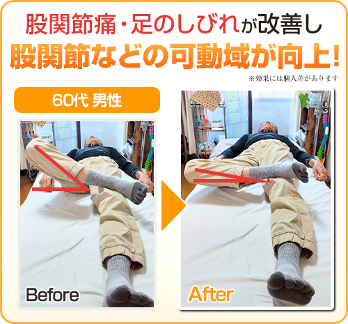 ビフォアフター