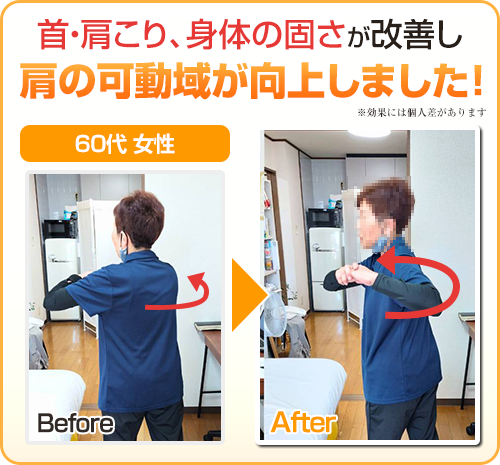 ビフォーアフター画像