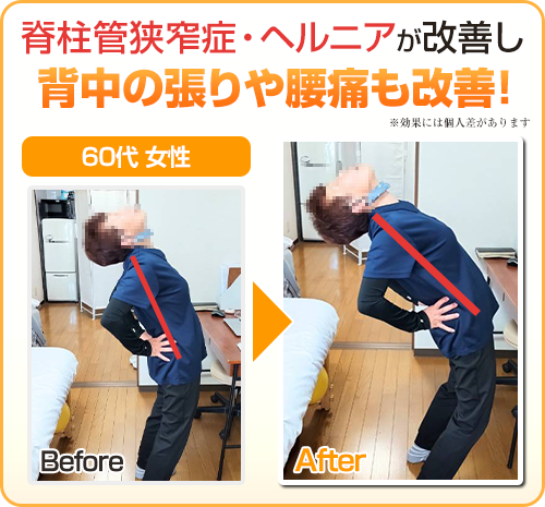 ビフォーアフター画像