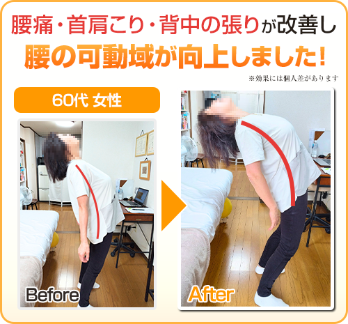 ビフォーアフター