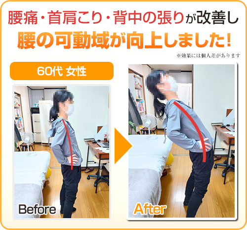 ビフォーアフター