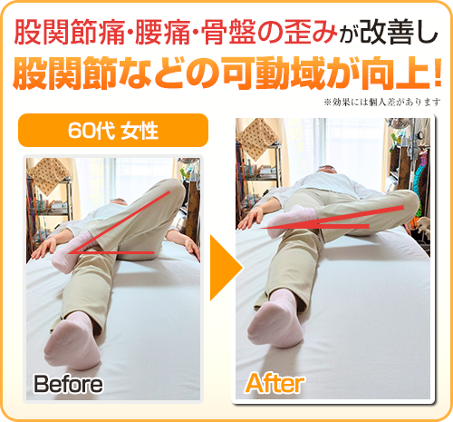 ビフォーアフター