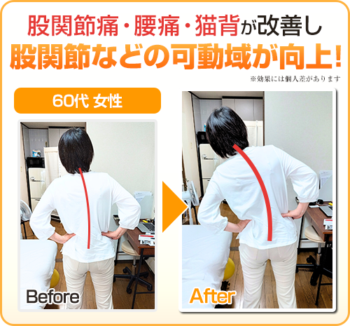 ビフォーアフター